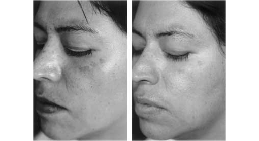 l-ascorbic acid_16 week l-ascorbic acid_16 week